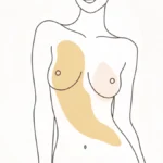 Do I Have a Ruptured Breast Implant Blog Image Dr Robert Owen