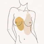 What is Capsular Contracture Blog Feature Image Dr Robert Owen Wide