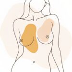 Enbloc Removal Abstract illustration of a woman's torso