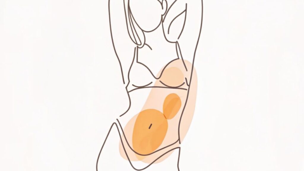 Surgery for Split Muscle Repair After Pregnancy Blog Image by Dr Robert Owen