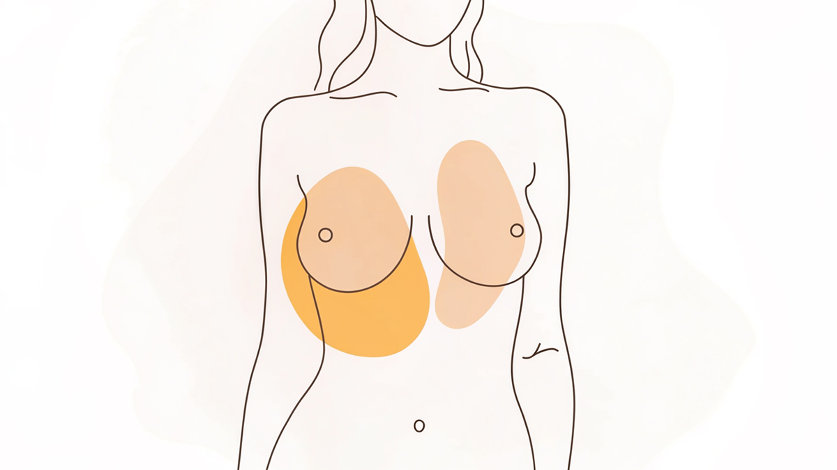 En Bloc vs Total Capsulectomy: Differences Explained – A Specialist’s Approach with Dr Robert Owen