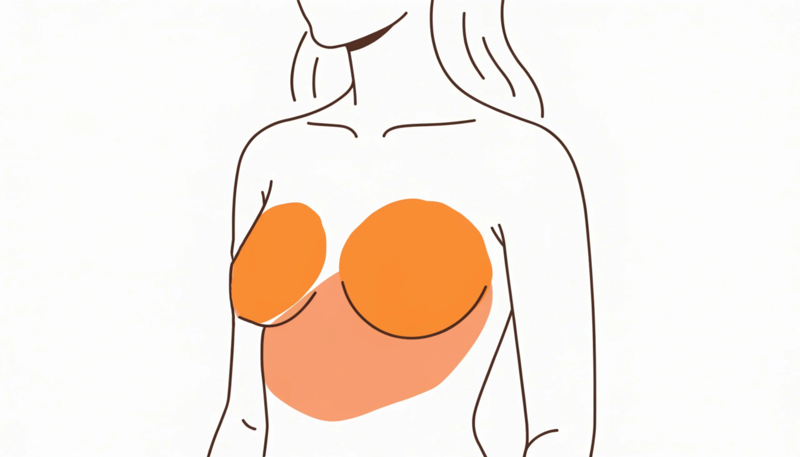 Natural Breast Restoration After Implant Removal
